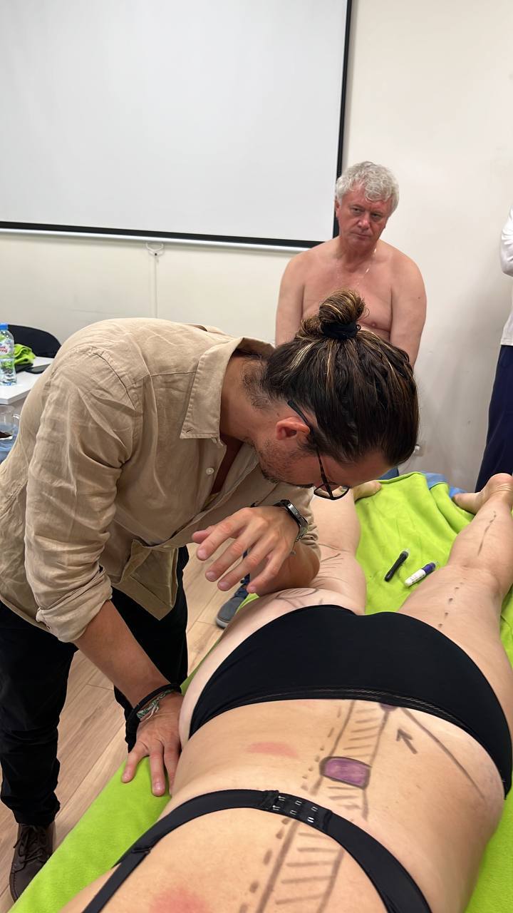 Метод Fascial Manipulation