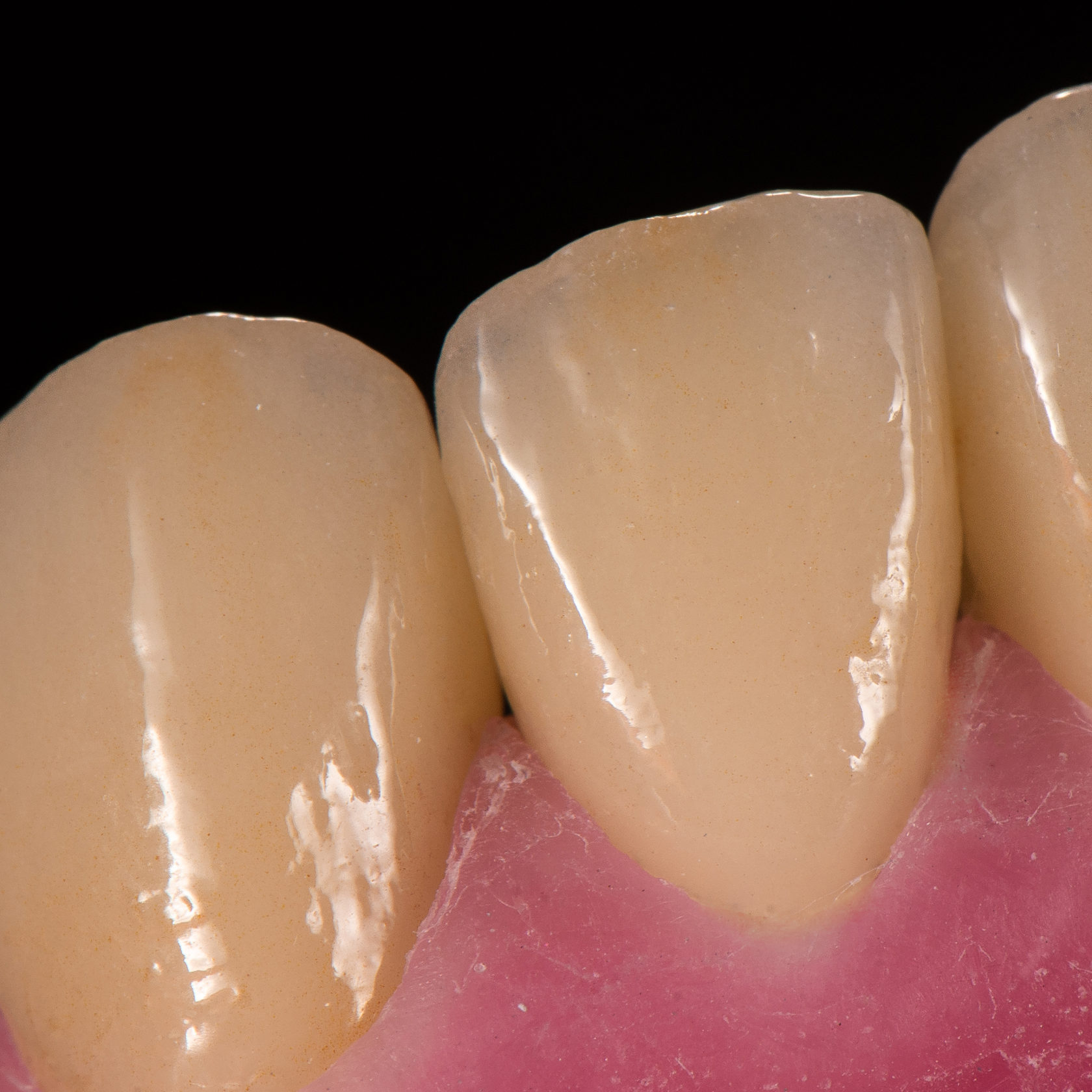 Эстетика в стоматологии