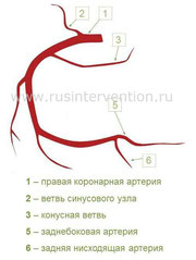 Сосуды сердца схема коронарография