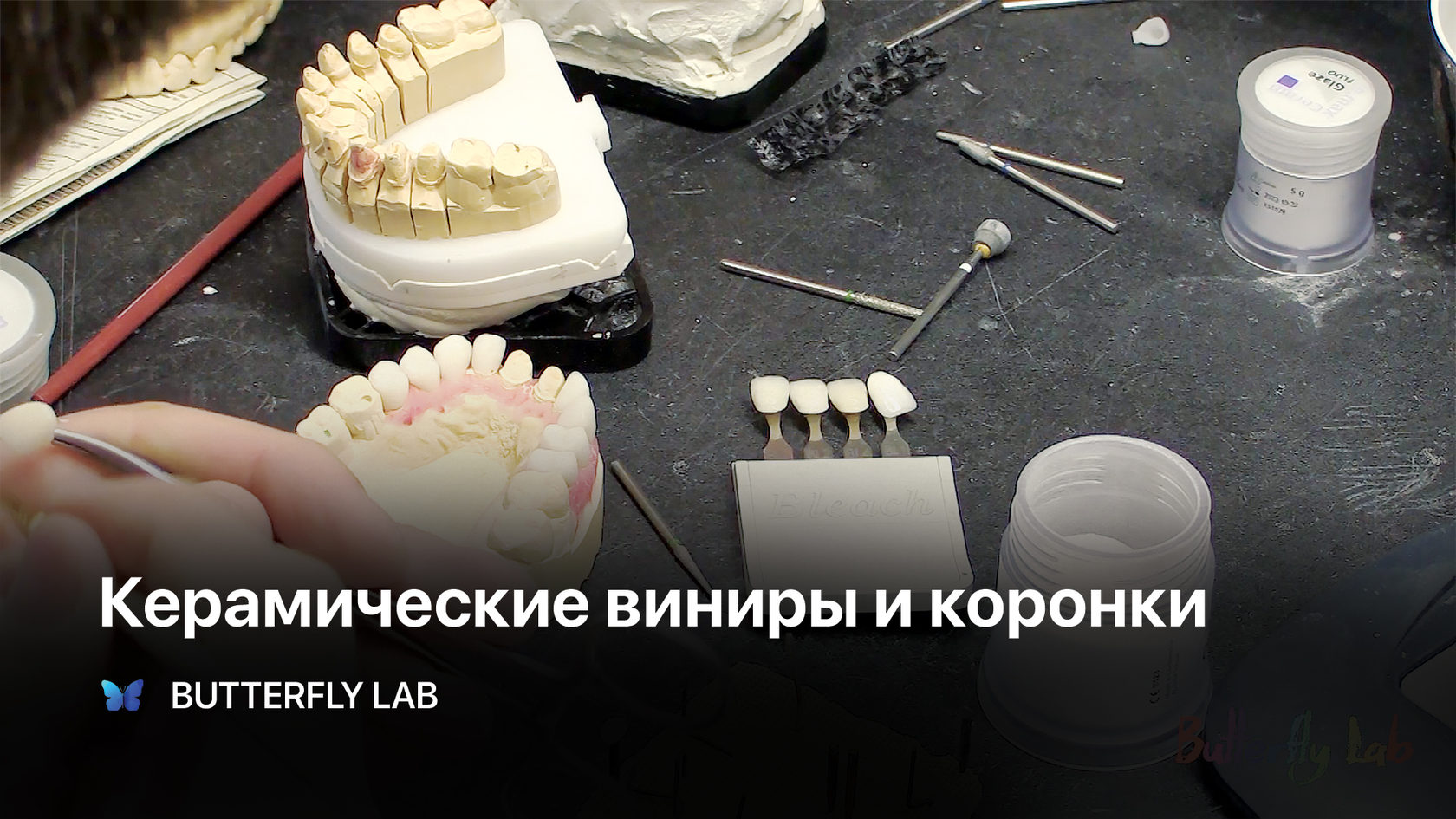 Эстетическая карта пациента