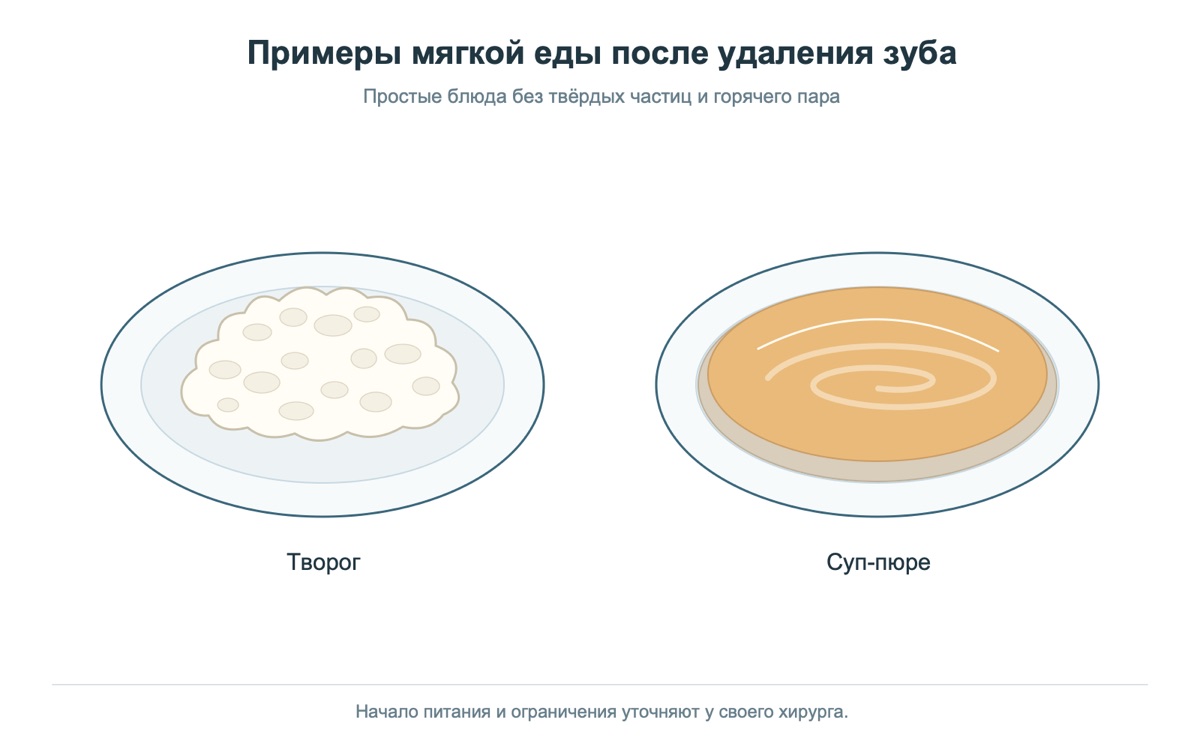 Примеры мягкой еды для питания после удаления зуба