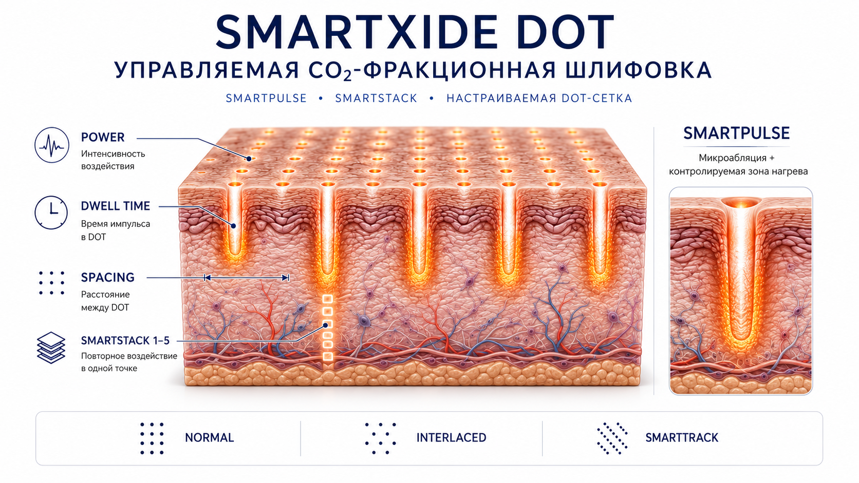 SmartXide DOT: Power, Dwell Time, Spacing, SmartStack, SmartPulse и режимы сканирования