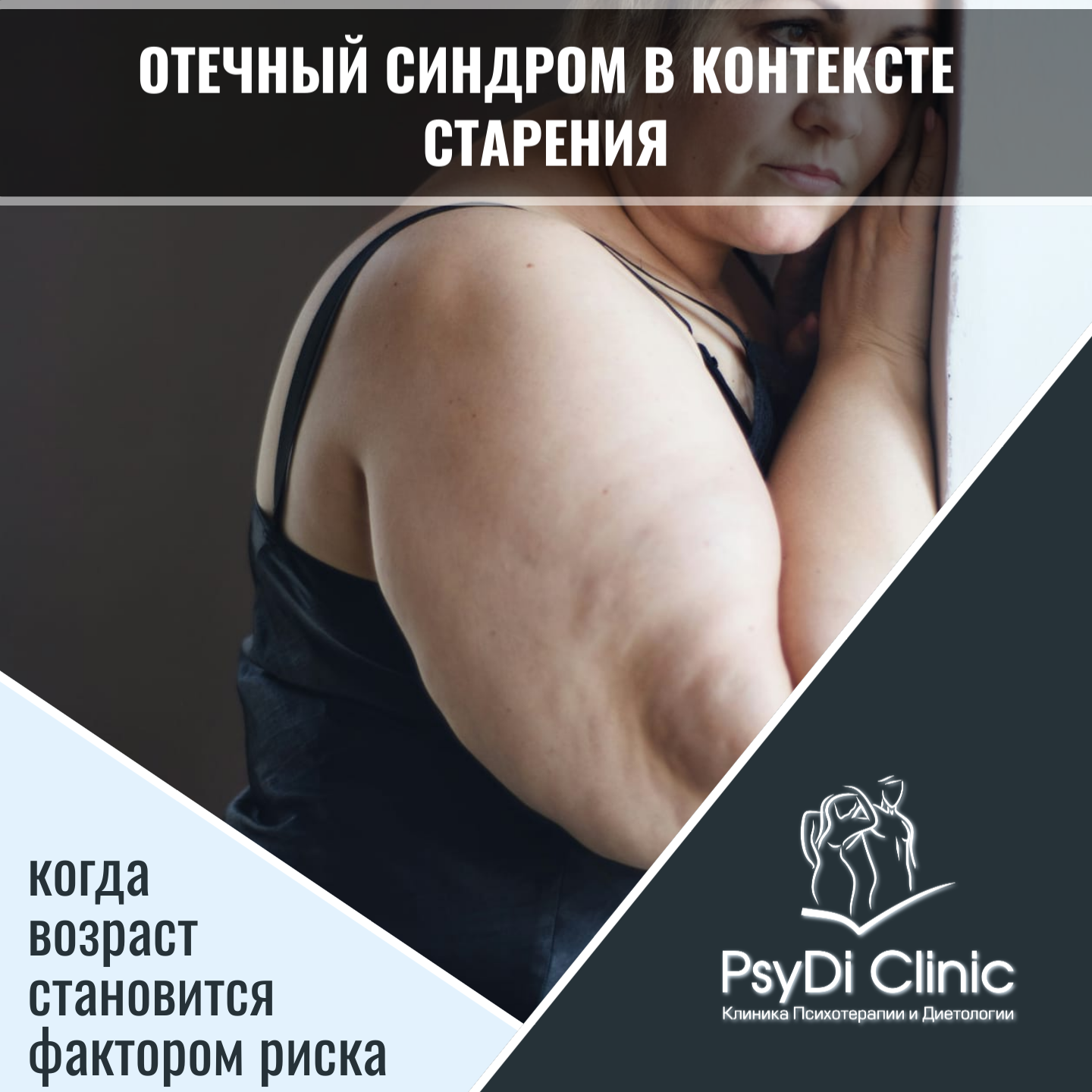 Отечный синдром в контексте старения: когда возраст становится фактором риска