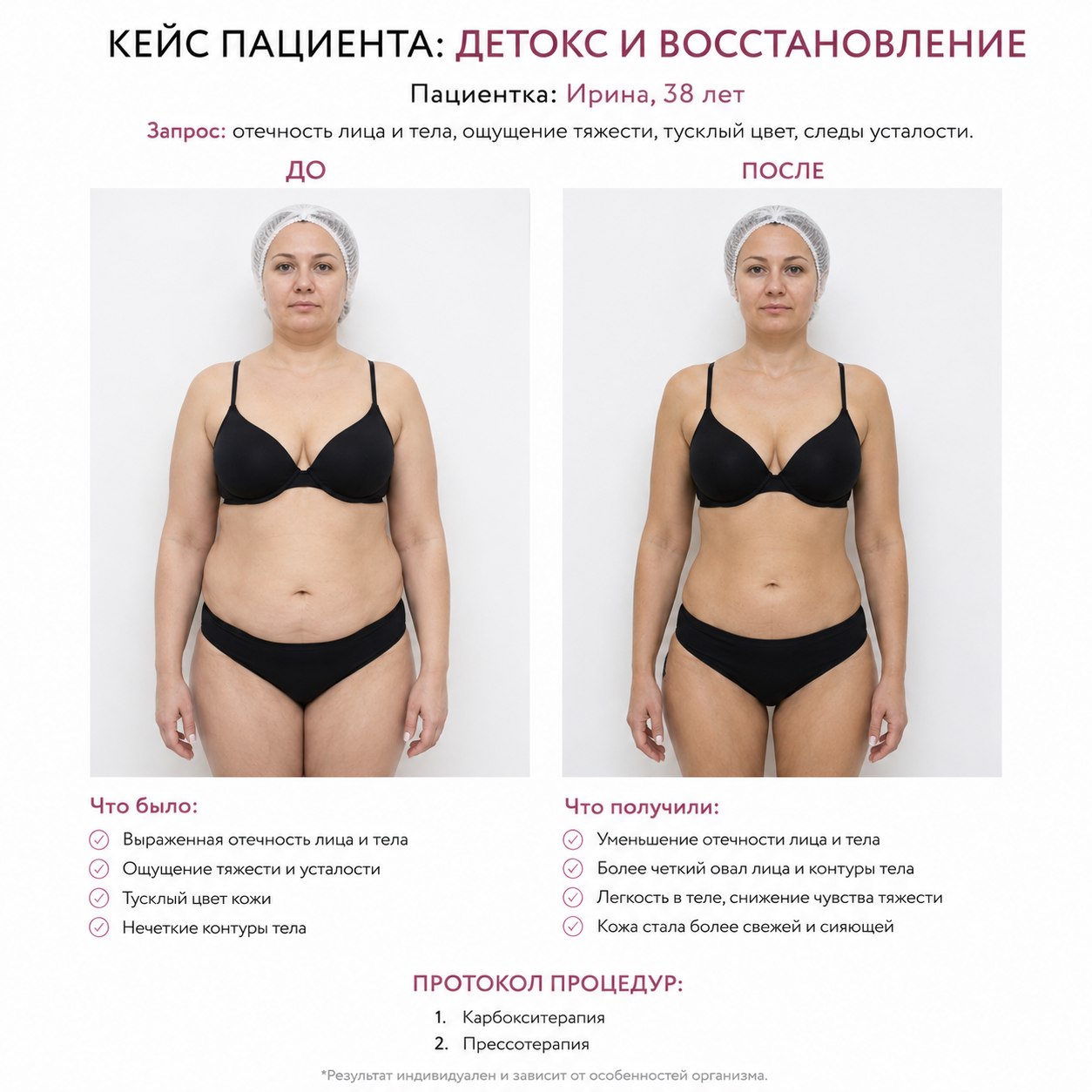Кейс пациента до и после