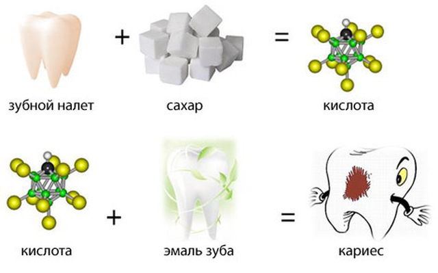 Причины возникновения кариеса