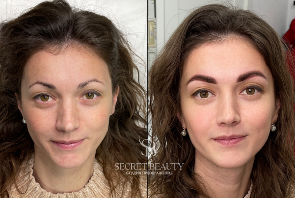 Фото лица до/после