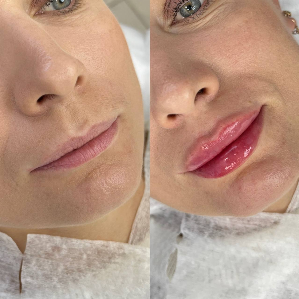 Материал из портфолио Inlove Beauty