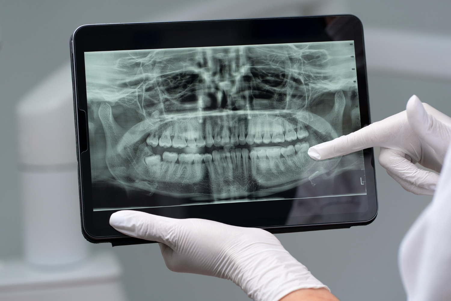 Дентальный томограф Ray RAYSCAN RCT700