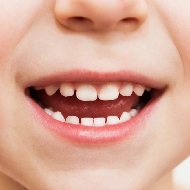 Молочные зубы картинки. Красивые зубы у детей.