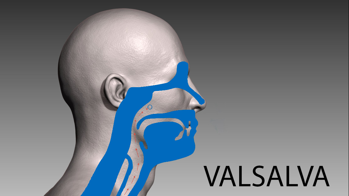 Comparing Frenzel and Valsalva which equalization technique is right