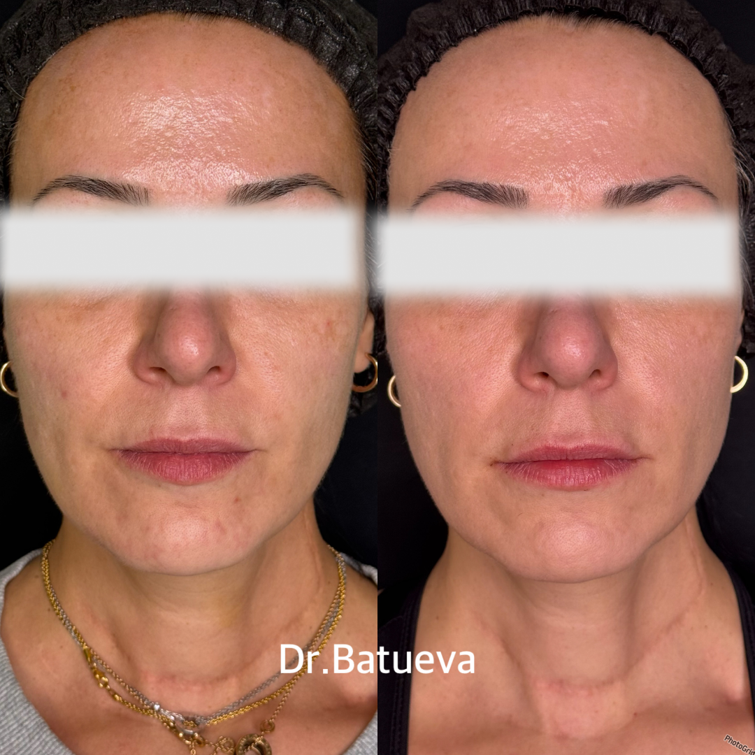 Результат Healthy Glow до и после, пример 2