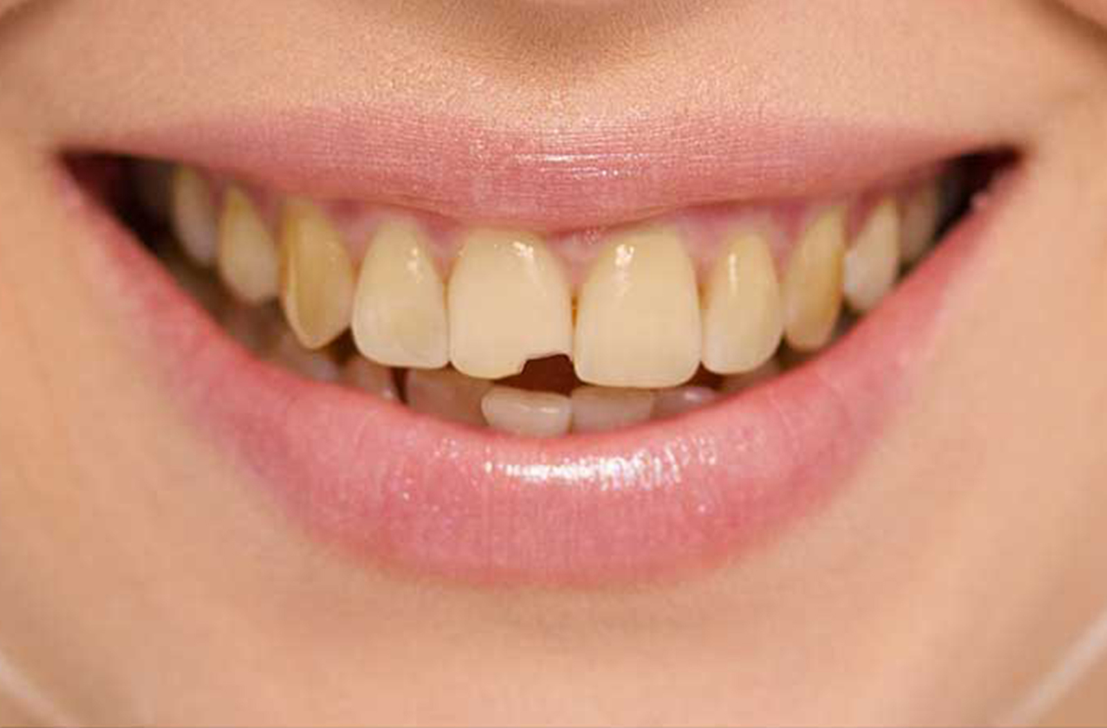 Example smile. Example smile