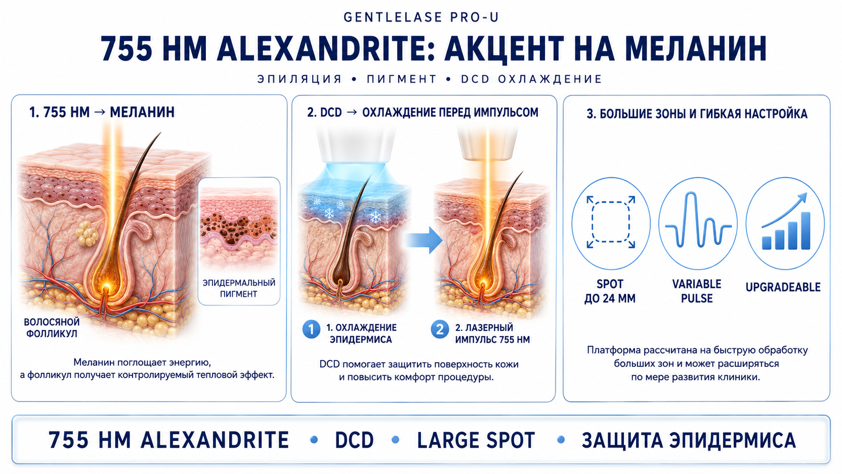 GentleLase Pro-U: александрит 755 нм и DCD