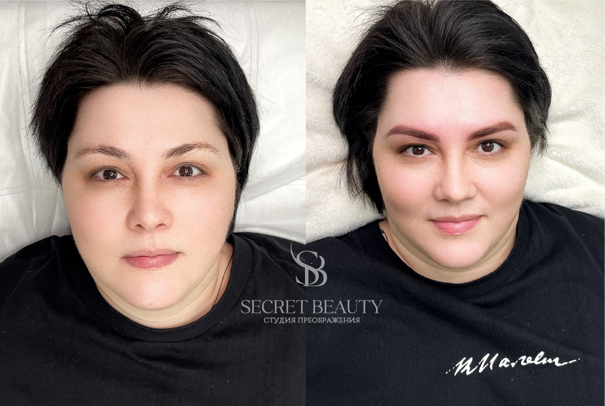 Фото лица до/после