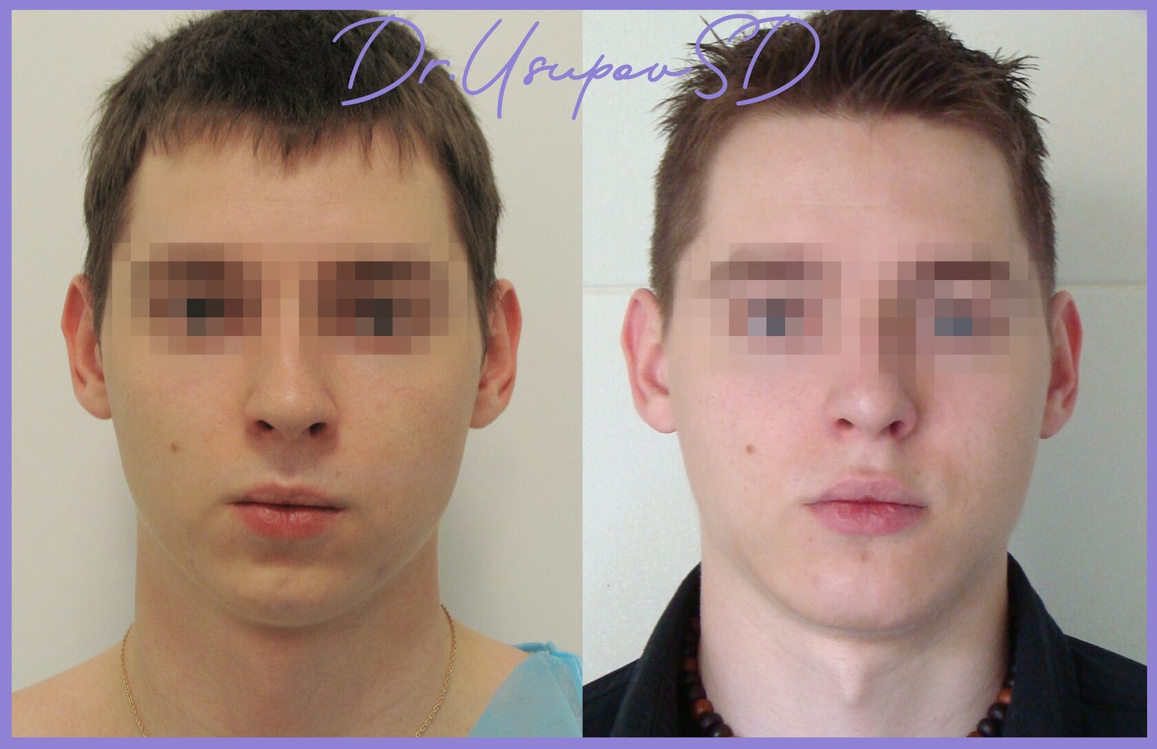 Филин после операции фото до и после