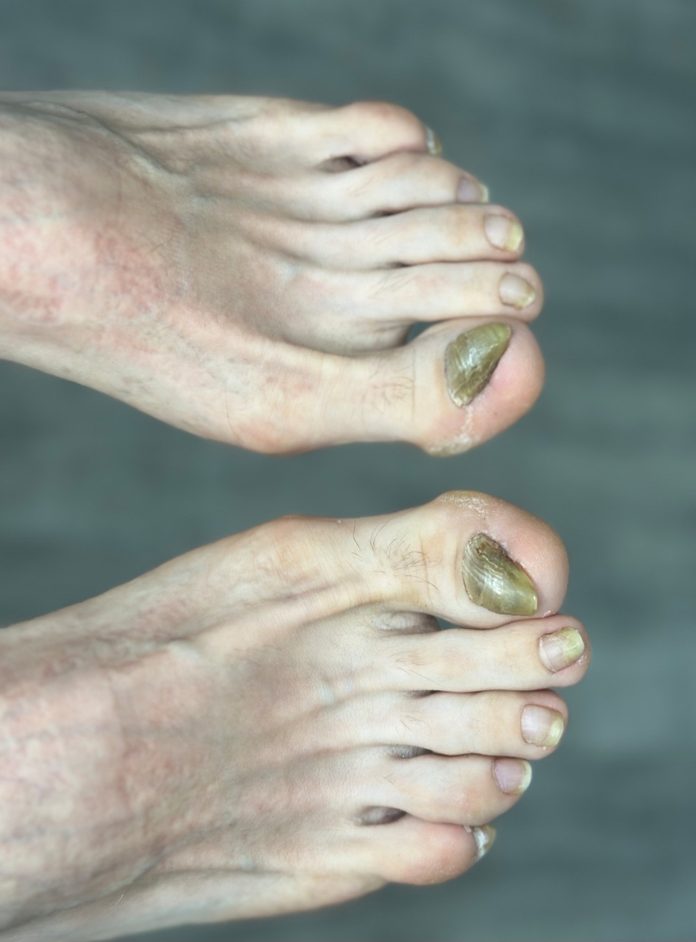 центр подологии и эстетики, адрес центр подологии, сайт центр подологии, мастер педикюра, аппаратный педикюр, профессиональный педикюр, восстановление ногтей, скрученные ногти