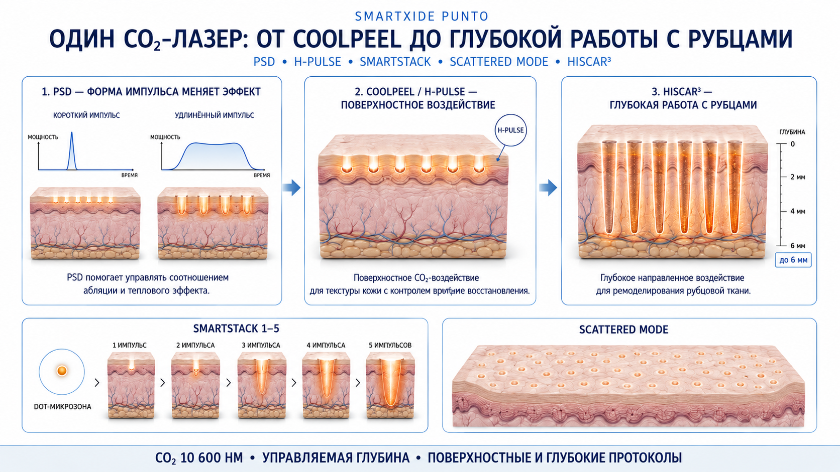 SmartXide Punto: схема CO₂‑воздействия 10 600 нм