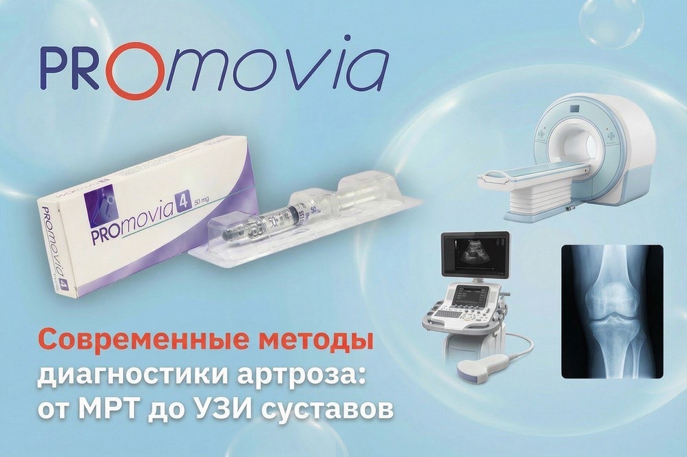 Современные методы диагностики артроза
