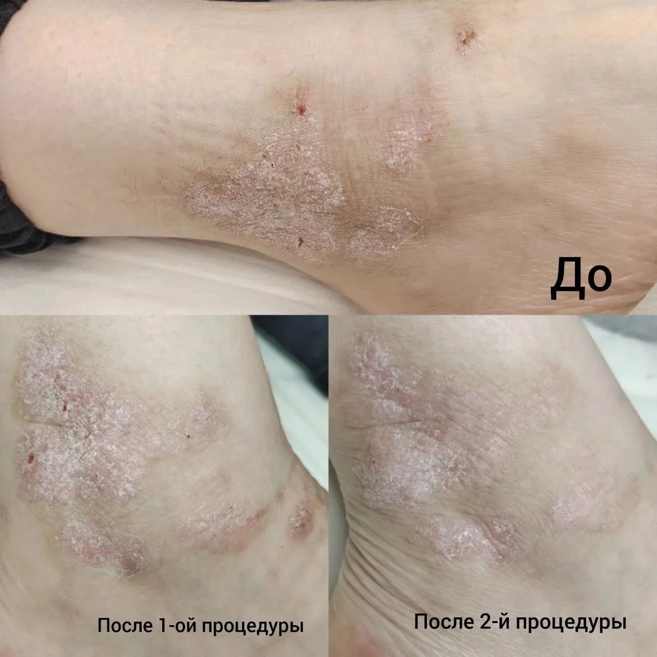 Результат 2