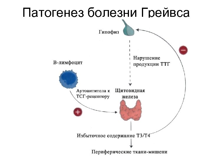 Патогенез дтз схема