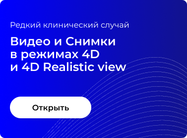 ВИДЕО И СНИМКИ В РЕЖИМАХ 4D И 4D REALISTIC VIEW