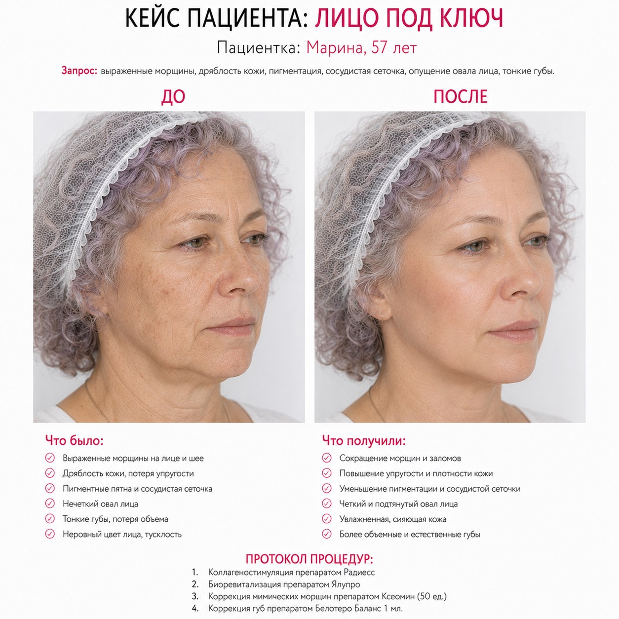 Кейс пациента до и после