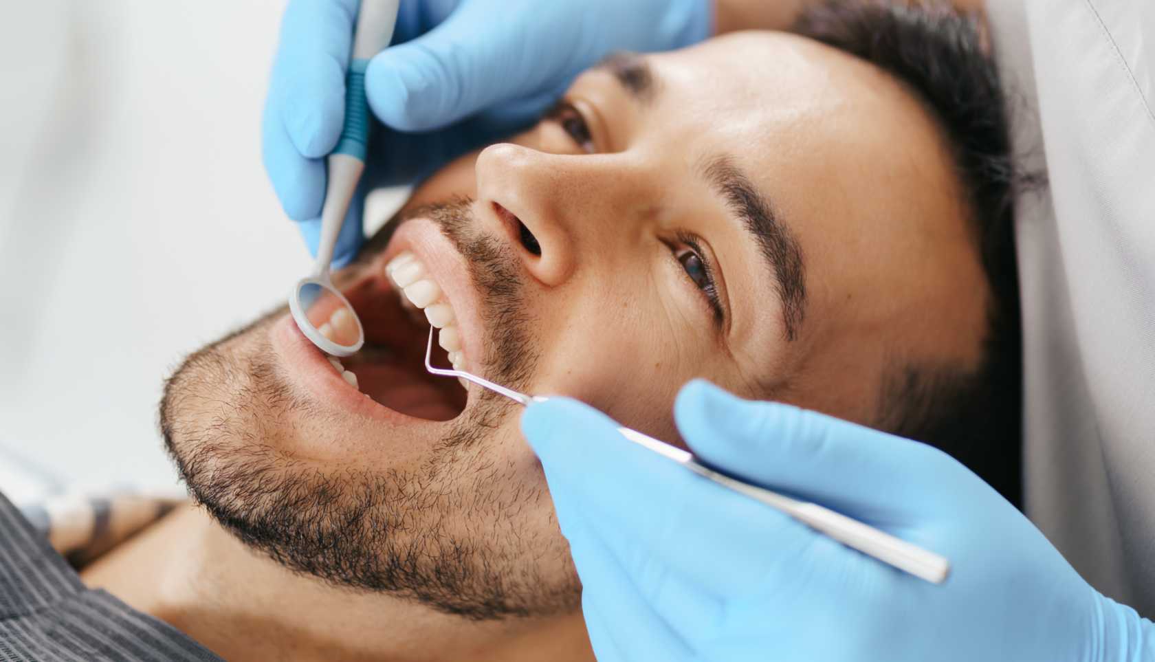 Как лечат кариес на передних зубах