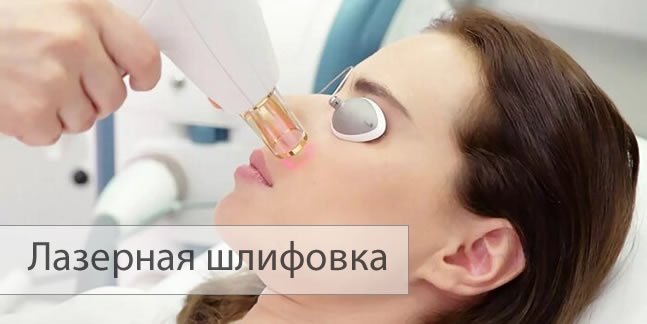 Лазерная шлифовка кожи лица, декольте и тела в клинике лазерной ...