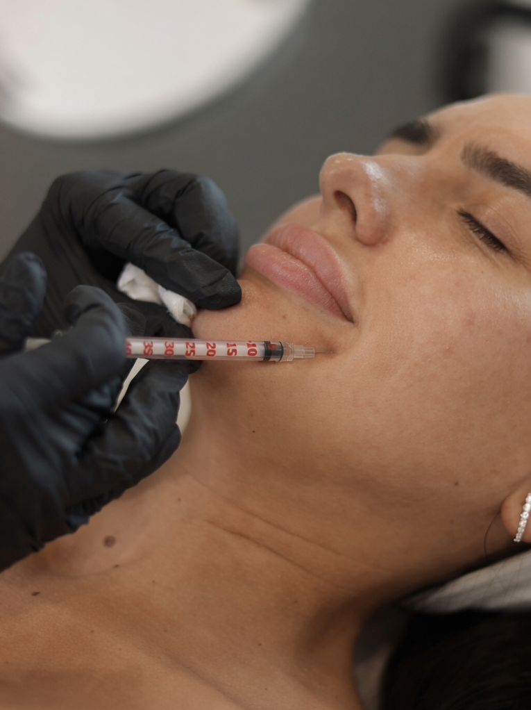 инъекции ботокса в межбровье в клинике Blvck Clinic Москва
