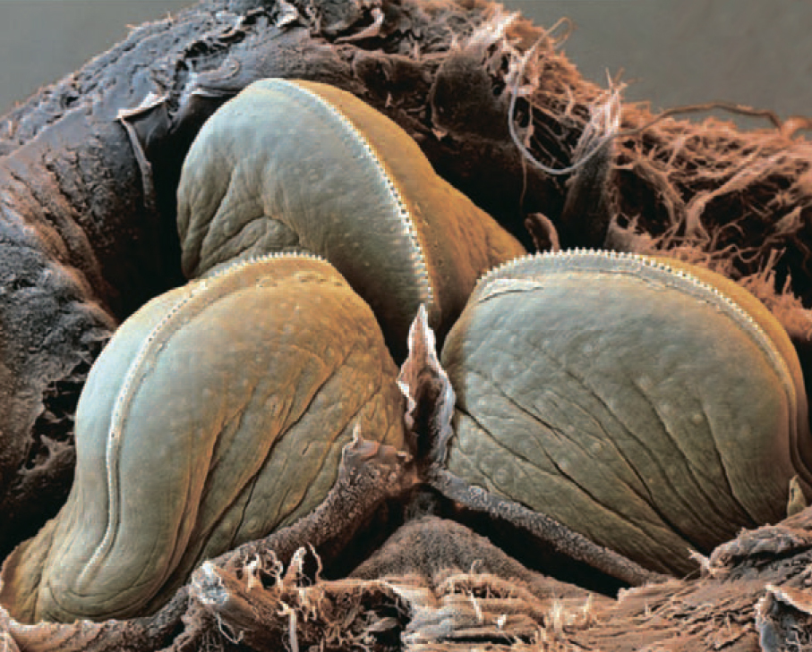 Челюсти медицинской пиявки под микроскопом.