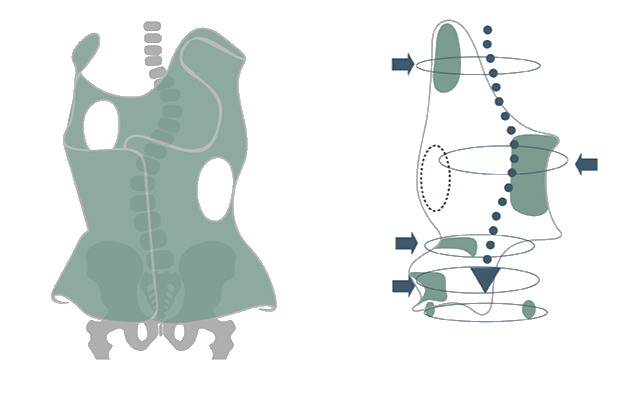 Корсет Шено