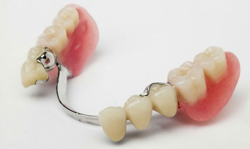 Протезирование при полном отсутствии зубов. Виды протезов, преимущества и недостатки