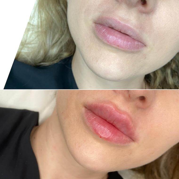 Как увеличить губы с помощью макияжа | OK BEAUTY | Дзен