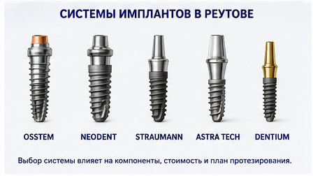 Системы имплантов Osstem, Neodent, Straumann, Astra Tech и Dentium в Реутове