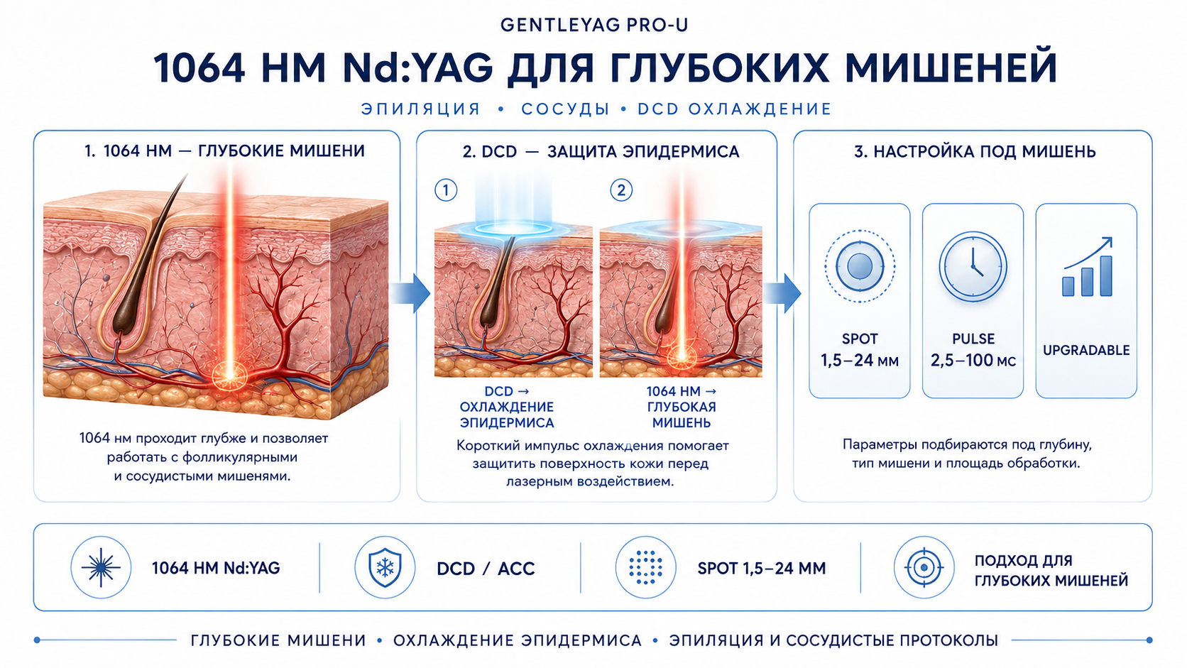 GentleYAG Pro-U: схема 1064 нм, DCD и пятен 1,5–24 мм