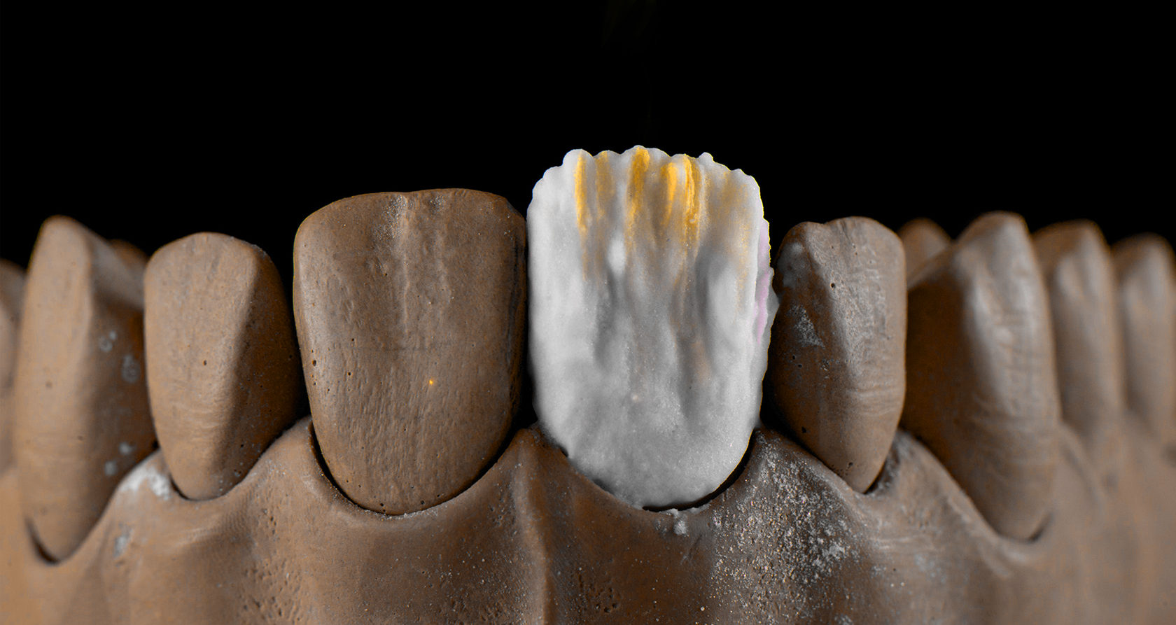 Зуботехническая лаборатория Москва Butterfly Lab