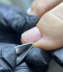 Подолог в Новороссийске