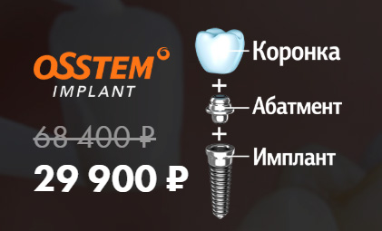 Имплантат осстем абатмент. Имплантат osstem корея. Имплантат под ключ акция. Осстем под ключ. Ключ osstem импланты.