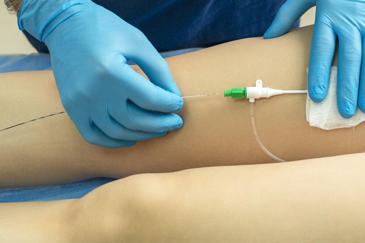 Лечение трофических язв во Владикавказе