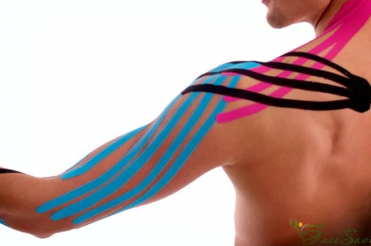 Тайпирование. Кинезиотерапия тейпирование. Кинезио тейп "Kinesiology Tape". Кинезио тейп лимфодренаж. Тейпирование шеи лимфодренаж.