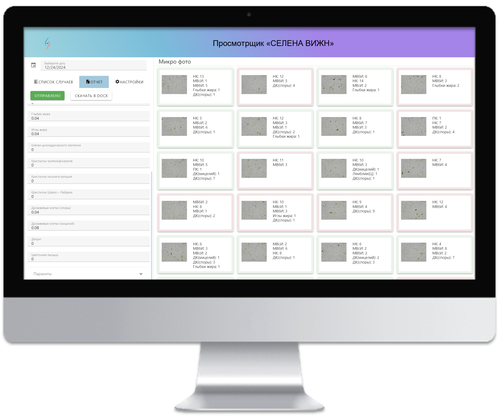 Просмотрщик цифровых снимков микроскопии препарата кала "Селена Вижн"