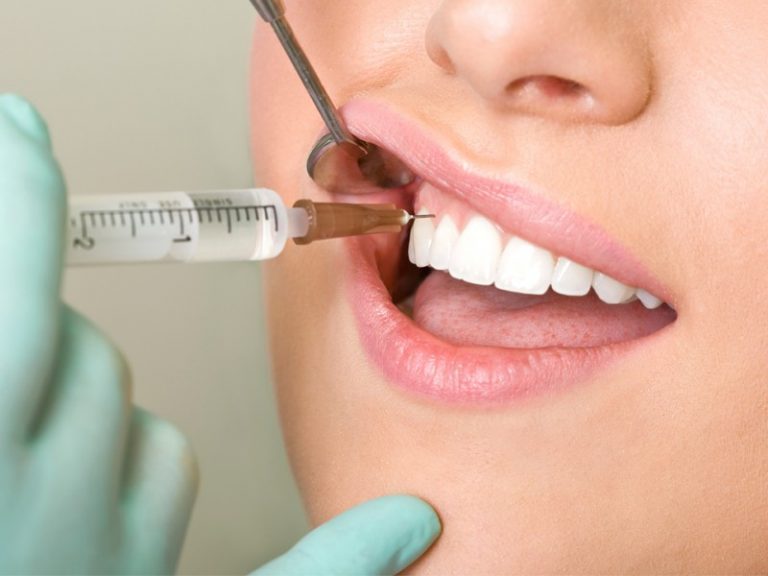 Эфект от применения гиалуроновой кислоты в стоматологии | MedicalCase