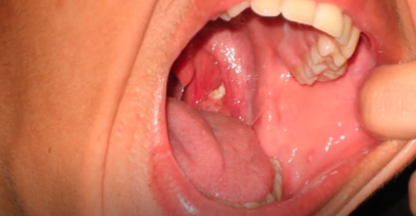 Ионизатор воды от неприятного запаха из рта