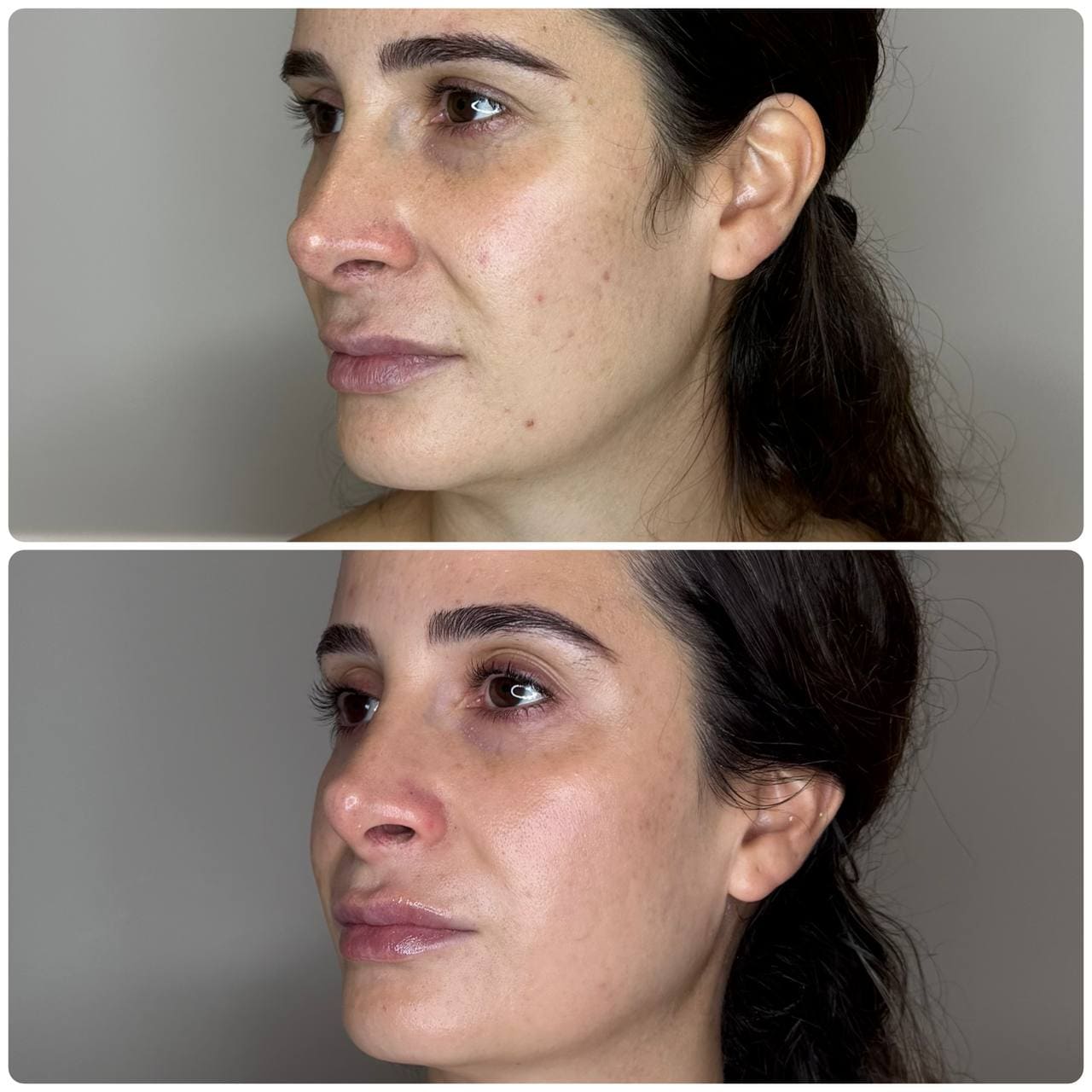RF and Microcurrent Facial at Beauty Studio by Hanna