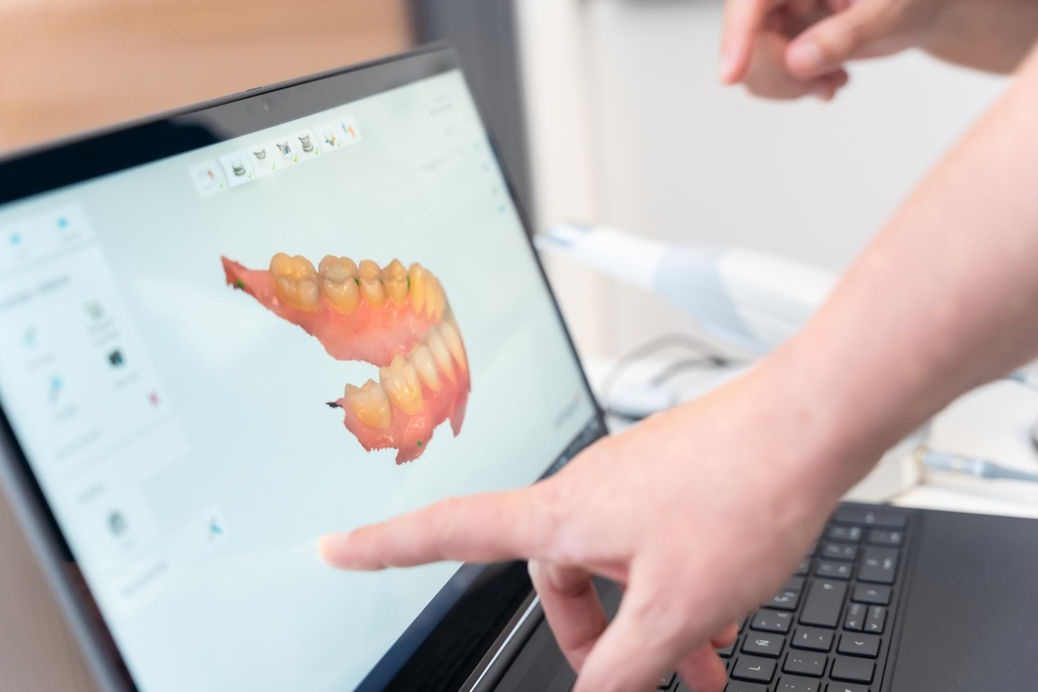 Интраоральный 3D-сканер Medit i700