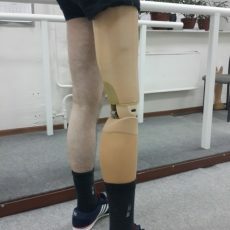 3-ос). Протез голени пнз-87 n14. Протез ноги чертеж. Протез бедра немодульный (пн6-36, пн6-35). Протез бедра модульный пн6-об.