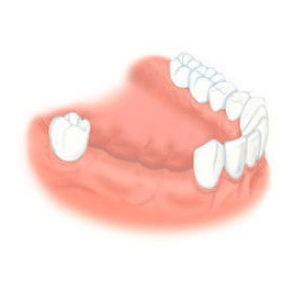 челюсть мало зубов