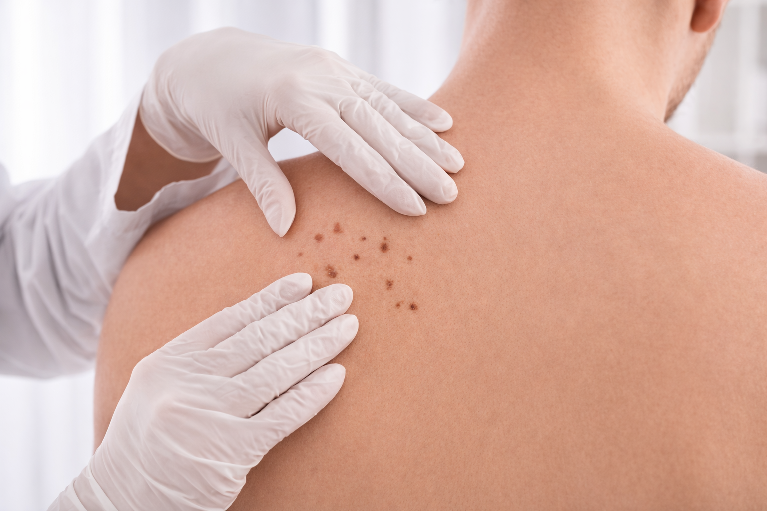 Дерматология и лечение кожи