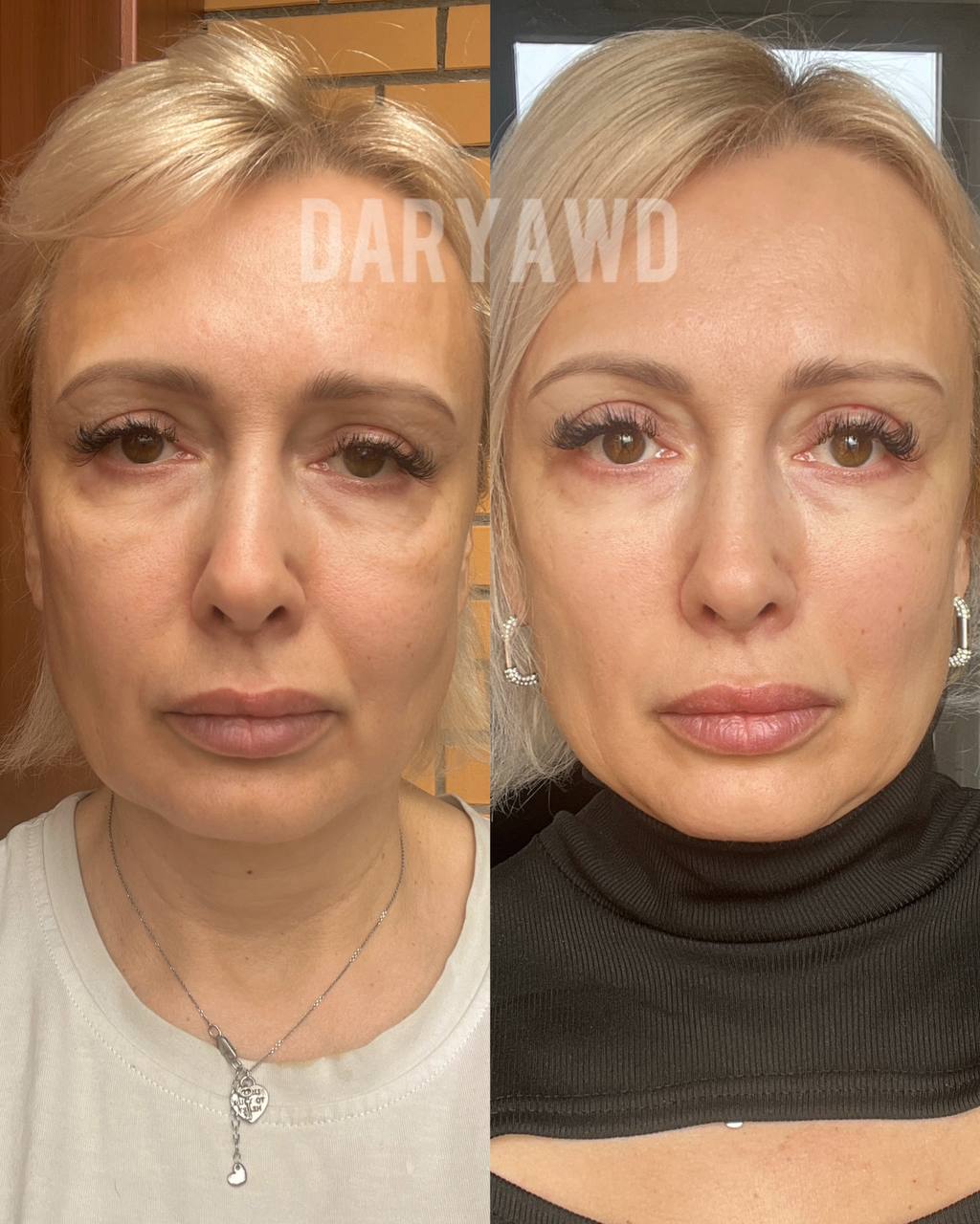 Елена, 48 лет