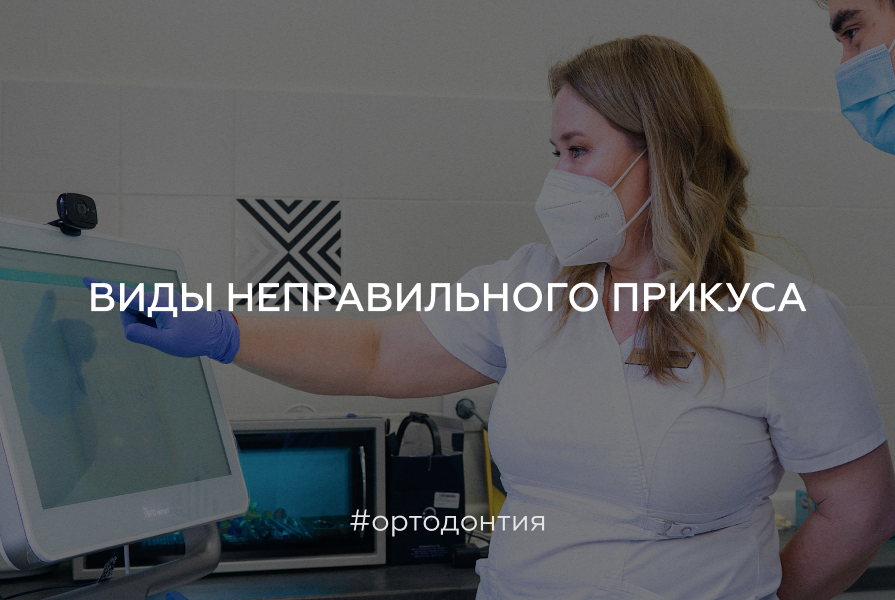 Виды неправильного прикуса